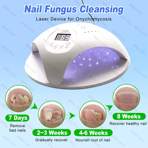 2-In-1 Fungal Nail Laser Device Repair Fast Nails Fungus Onychomycosis Repair Toenail Fingernail Removes Nail Fungus Foot Care