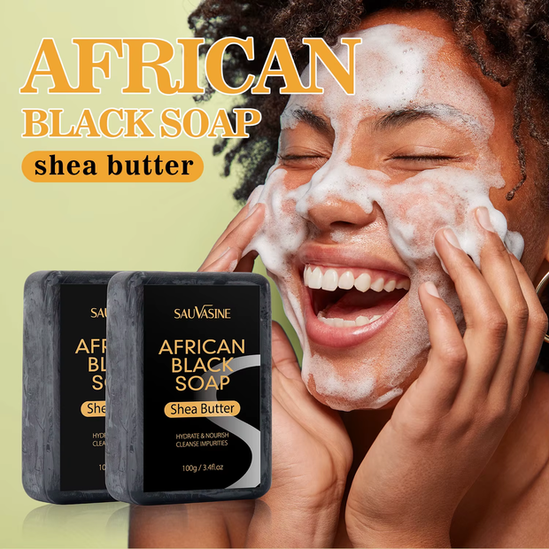 African Black Soap – Acne Treatment for Clear Skin!